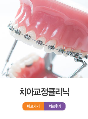 치아교정클리닉